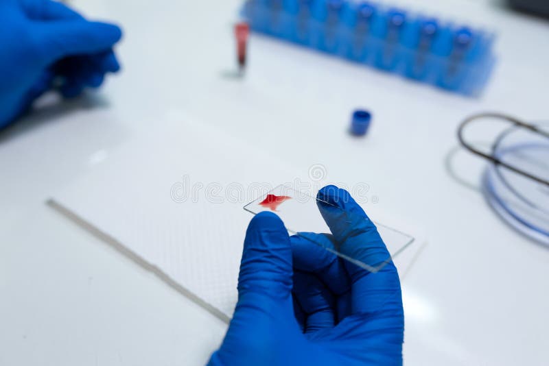 Scientist Prepare Blood Sample for Research on Microscope. Placing