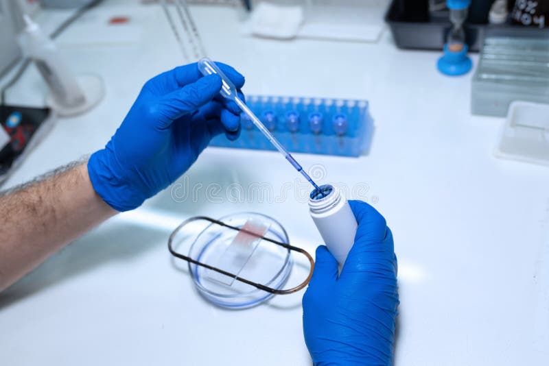 Scientist Prepare Blood Sample for Research on Microscope. Placing