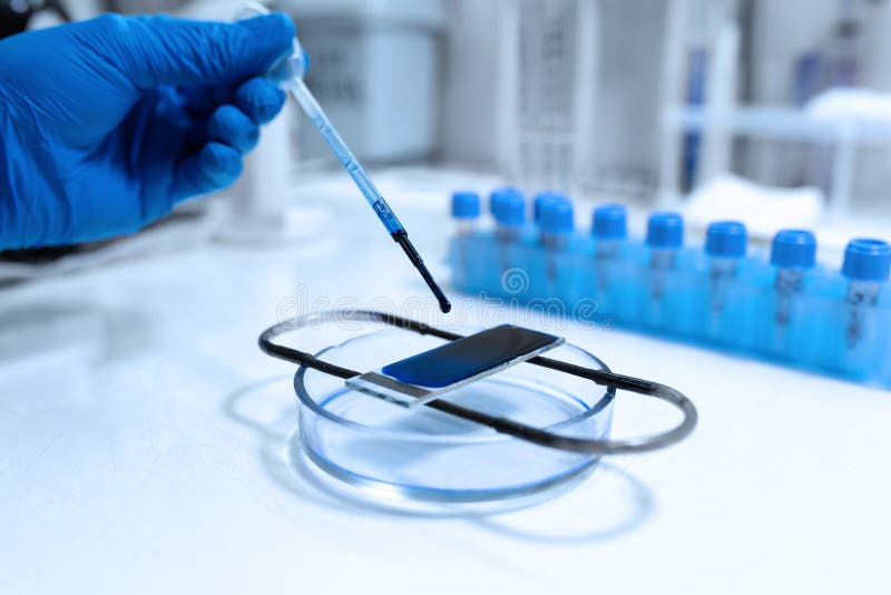 Scientist Prepare Blood Sample for Research on Microscope. Placing