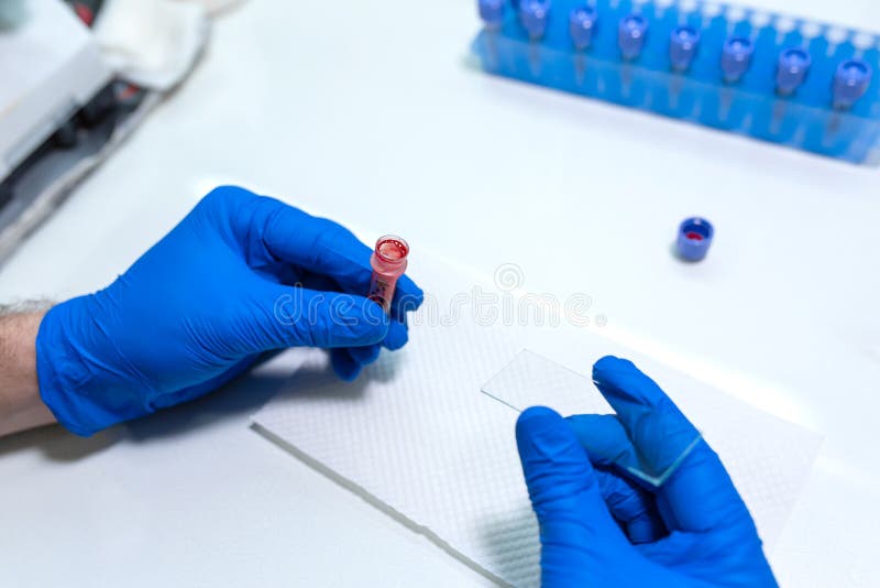 Scientist Prepare Blood Sample for Research on Microscope. Placing