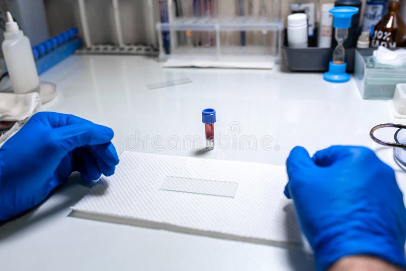 Scientist Prepare Blood Sample for Research on Microscope. Placing