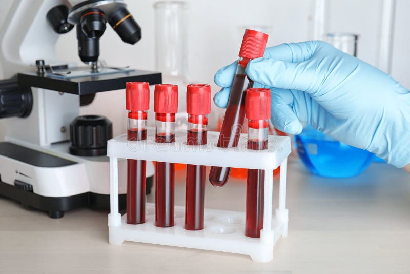 Scientist Taking Test Tube from Rack. Laboratory Analysis Stock Photo ...