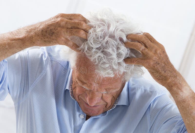 Scratching head stock image. Image of medical, dermatitis 61914495