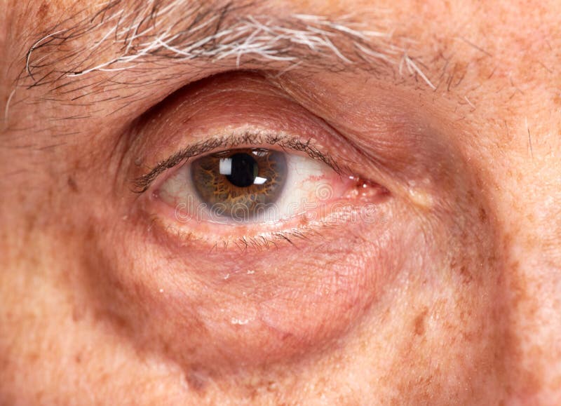 Senior man eyes. stock photo. Image of male, face, ophthalmology 78703128