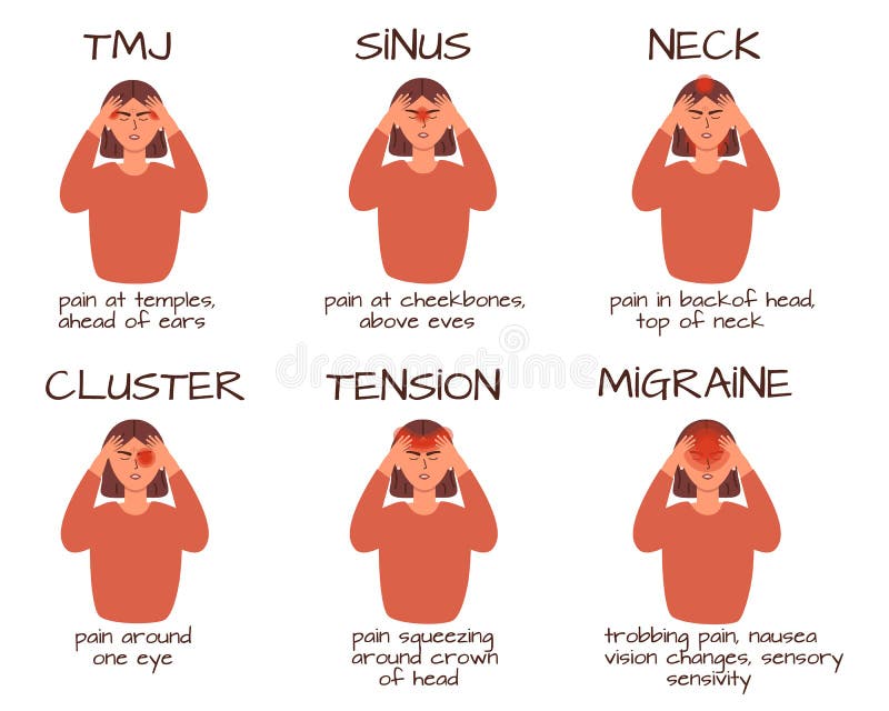 Migraine Sinus Headache Stock Illustrations 91 Migraine Sinus Headache Stock Illustrations Vectors Clipart Dreamstime