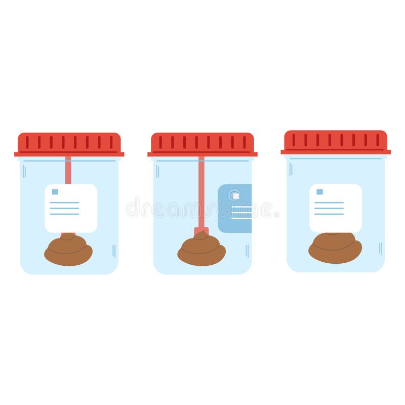Set of stool analysis in beakers. Poop test. Plastic container with feces sample royalty free illustration
