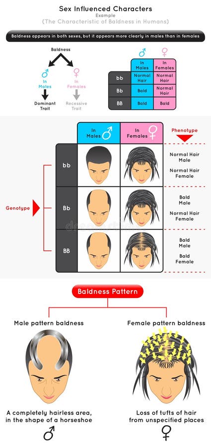 Sex Influenced Characters Infographic Diagram example characteristic of baldness in human