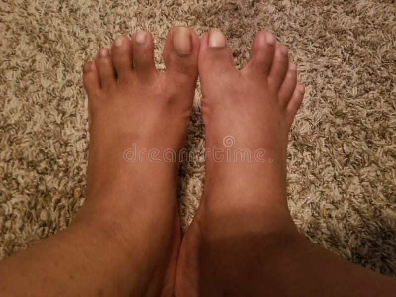 Feet pretty brown 