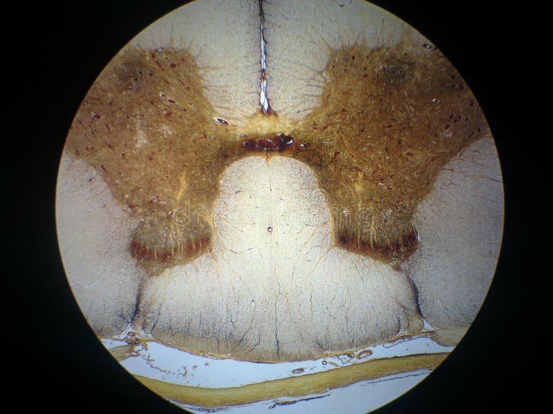 Sezione trasversale del midollo spinale