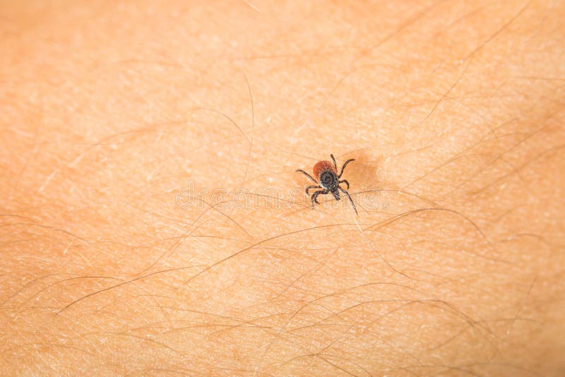 Tick - parasitic arachnid blood-sucking carrier of various diseases. Tick - parasitic arachnid blood-sucking carrier of various diseases