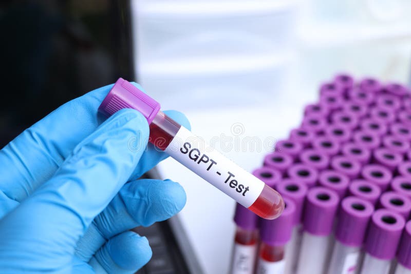 SGPT Test To Look for Abnormalities from Blood Stock Image Image of