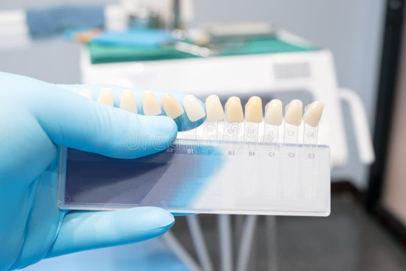 317 Dental Shade Guide Stock Photos Free & RoyaltyFree Stock Photos