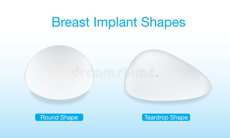 Changes in nipple shape, illustration - Stock Image - F034/4697