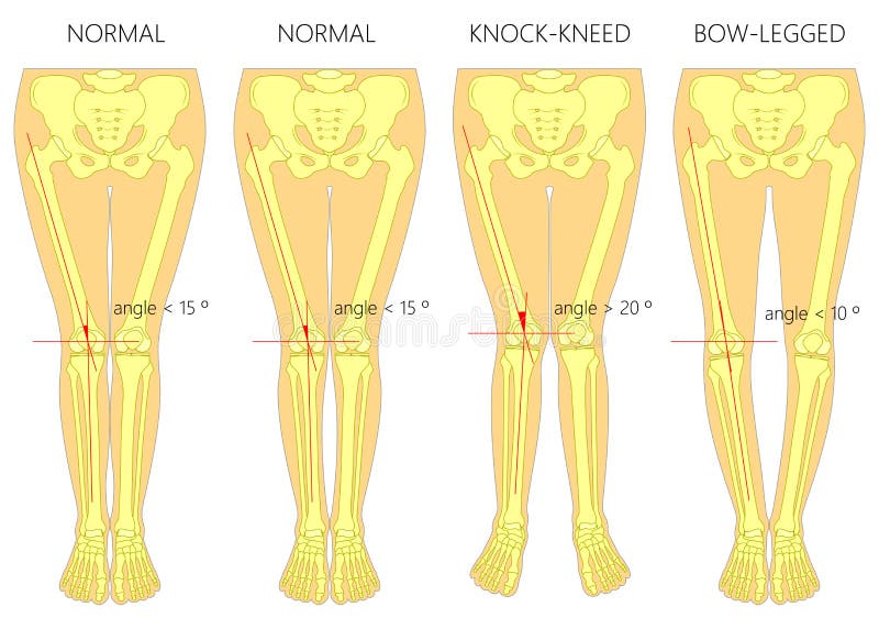 Types Of Knees Shapes