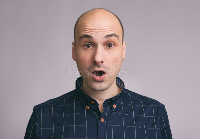 Shocked young bald man with open mouth royalty free stock photography