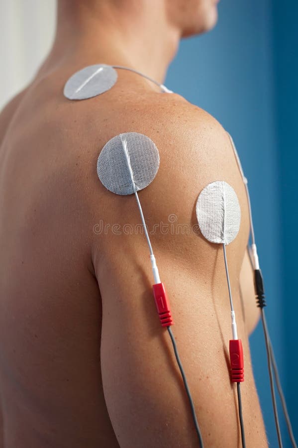 Shoulder Electrical Stimulation / TENS Stock Image - Image of stimulation,  glenoid: 58973823