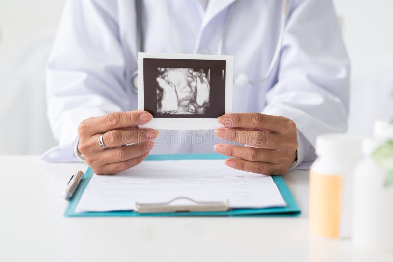 Showing Ultra Sound Scan Photo of Baby Stock Image - Image of ...