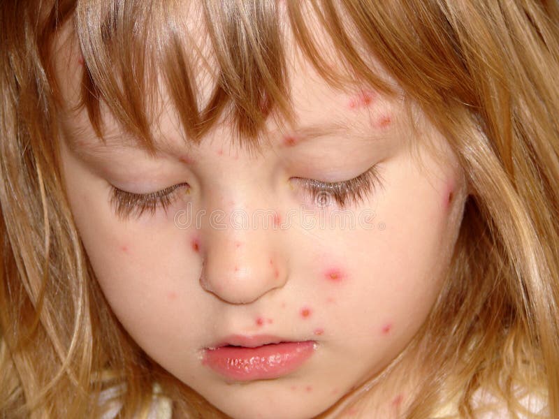 Sick girl stock photos