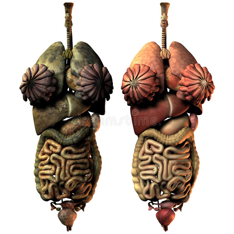 Sick And Healthy Internal Organs Of The Woman Stock Illustration - Illustration of bronchial ...