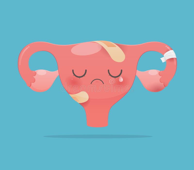 Sick uterus stock vector. Illustration of menses, leucorrhoea - 143140047
