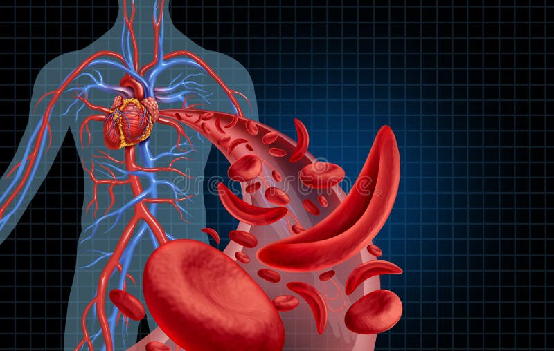 Genetic Heart Disease Illustration Stock Illustrations – 556 Genetic Heart  Disease Illustration Stock Illustrations, Vectors & Clipart - Dreamstime