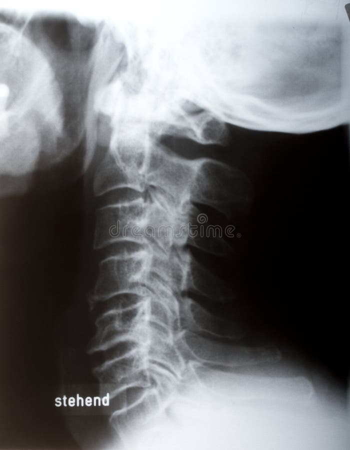 Human neck sidelong in x-ray. Human neck sidelong in x-ray