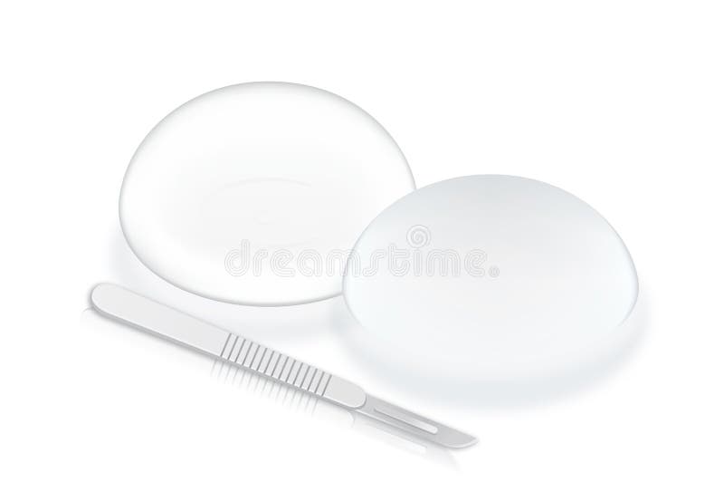 Breast Implants Stock Illustrations – 116 Breast Implants Stock  Illustrations, Vectors & Clipart - Dreamstime