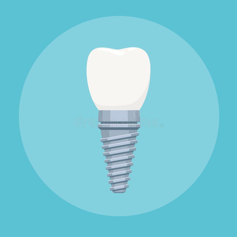 Sinal do implante dental ilustração royalty free Sinal do implante dental ilustração royalty free