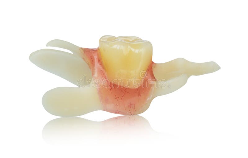 Single Artificial Denture False Tooth Elastic Prosthesis Stock