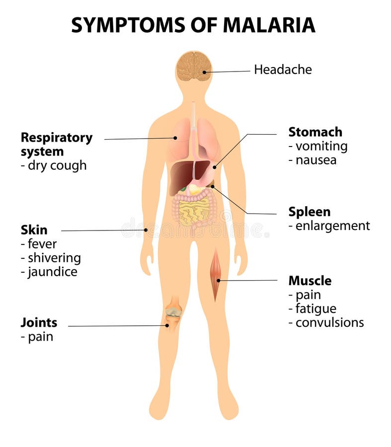 Symptoms of malaria. How to Recognize the Signs of malaria. Disease and organs on silhouette man. Symptoms of malaria. How to Recognize the Signs of malaria. Disease and organs on silhouette man