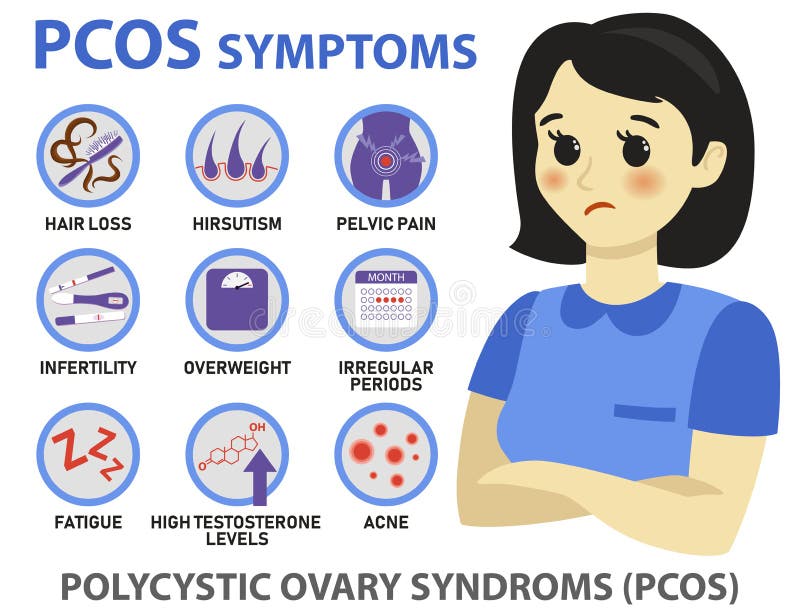Sintomi del infographics di PCOS Infographics dettagliato di vettore royalty illustrazione gratis Sintomi del infographics di PCOS Infographics dettagliato di vettore royalty illustrazione gratis