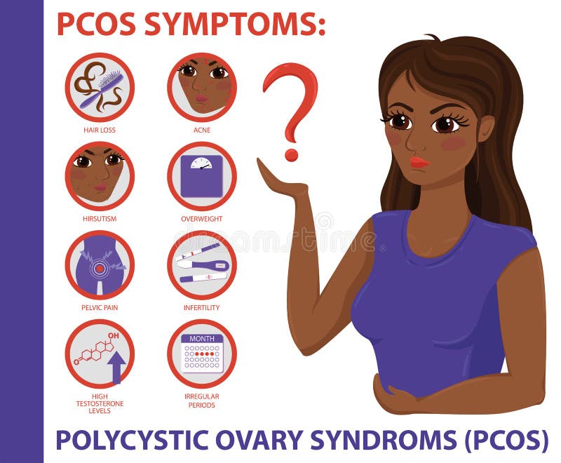 Sintomi di PCOS infographic Salute delle donne illustrazione di stock Sintomi di PCOS infographic Salute delle donne illustrazione di stock
