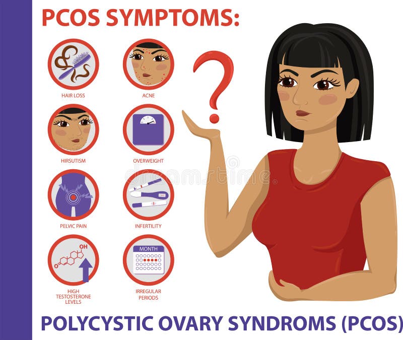 Sintomi di PCOS infographic Salute delle donne illustrazione di stock Sintomi di PCOS infographic Salute delle donne illustrazione di stock