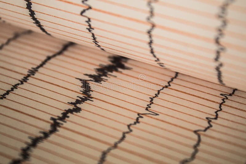 Sinus Heart Rhythm On Electrocardiogram Record Paper Showing Normal P Wave. Sinus Heart Rhythm On Electrocardiogram Record Paper Showing Normal P Wave.