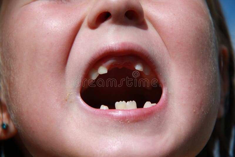 A child losing milk teeth stock photo. Image of teeth - 112772486