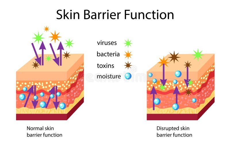 Skin Barrier Function, Normal and Disrupted, Vector Illustration Stock