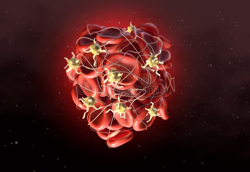 Skrzeplina w bloodstream, zakrzep z aktywowanymi platelets i fibrin 3D ilustracja, medically ilustracja wektor Skrzeplina w bloodstream, zakrzep z aktywowanymi platelets i fibrin 3D ilustracja, medically ilustracja wektor
