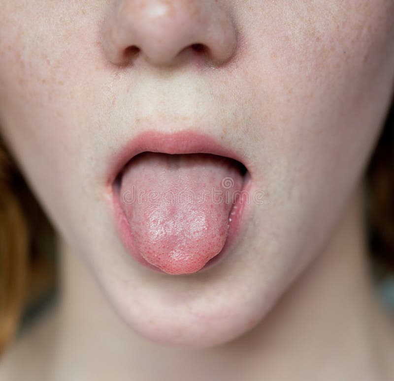 Van De De Sproetenvrouw Van De Tong Open Mond Jong Mooi Het