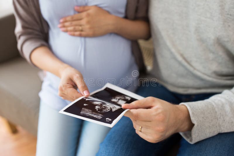 Sluit omhoog van paar met de beelden van de babyultrasone klank royalty-vrije stock foto's Sluit omhoog van paar met de beelden van de babyultrasone klank royalty-vrije stock foto's