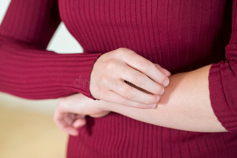 Slut upp av kvinnan med hudklagomålet som skrapar armen arkivbild Slut upp av kvinnan med hudklagomålet som skrapar armen arkivbild