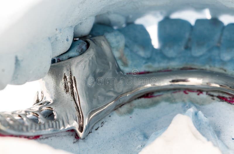 Slut upp den partiska tandprotesen på en murbrukform