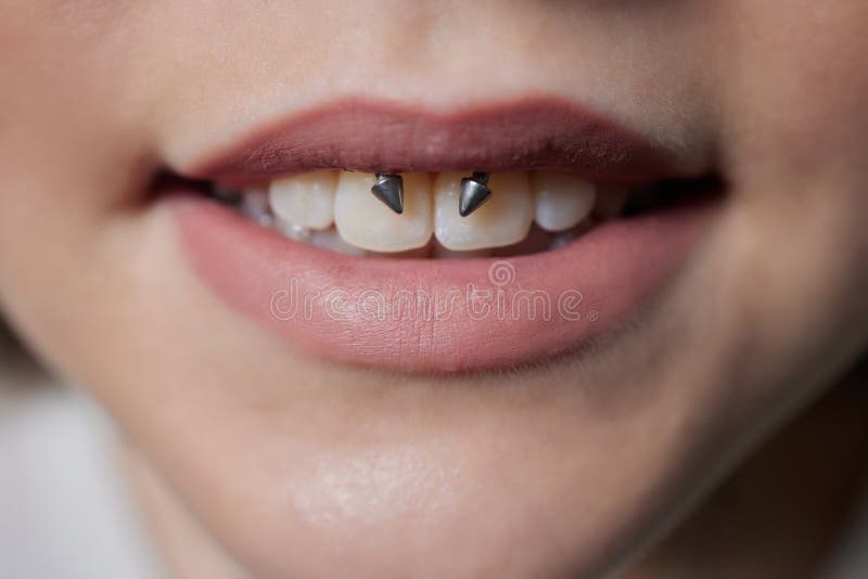 Smile Or Frenulum Piercing Under The Upper Lip Stock Image Image Of
