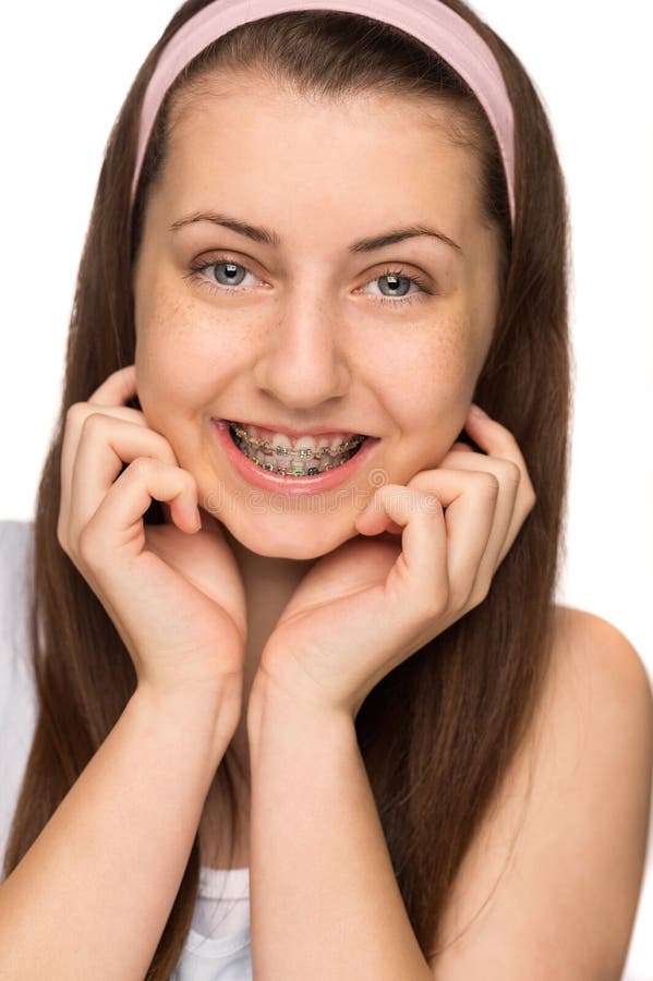 Smiling Girl with Braces Isolated Stock Image - Image of closeup, hair ...