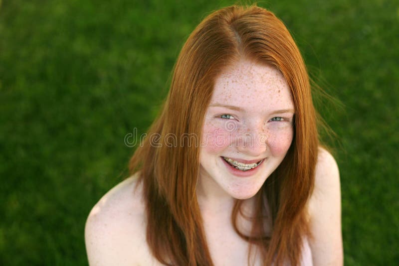 Smiling Girl with Braces and Red Hair Stock Image - Image of female,  emotions: 14547111