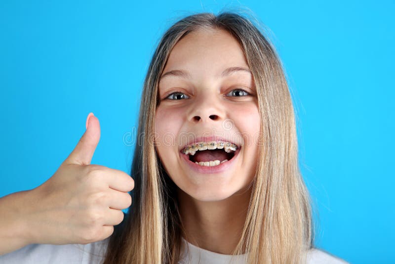 Smiling Girl With Dental Braces Stock Image Image Of Dental Human 125453645