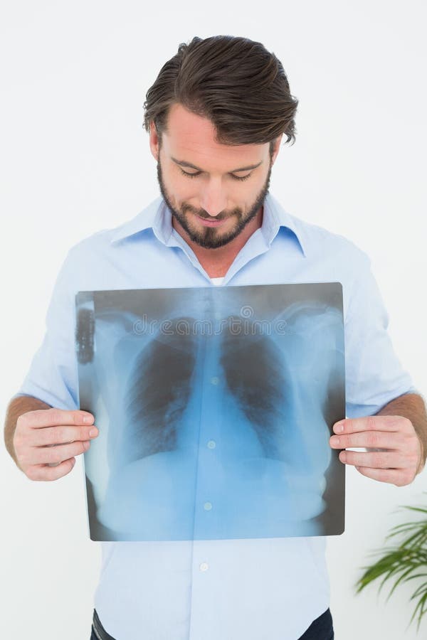 Smiling young man holding lung xray