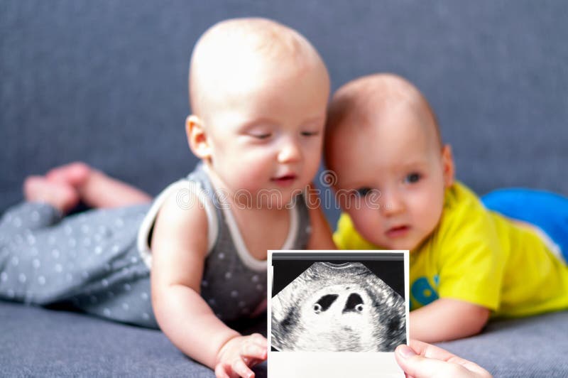 A snapshot of an ultrasound of pregnancy twins 4 weeks in foreground in focus. Gemini boy and girl in background out of focus.