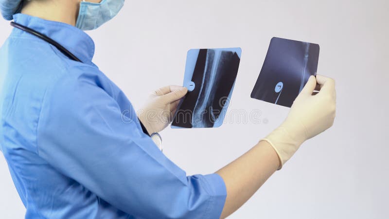 Soignez analyser le rayon X blessé d'os, faisant le diagnostic, chirurgie d'hôpital, le travail images stock Soignez analyser le rayon X blessé d'os, faisant le diagnostic, chirurgie d'hôpital, le travail images stock
