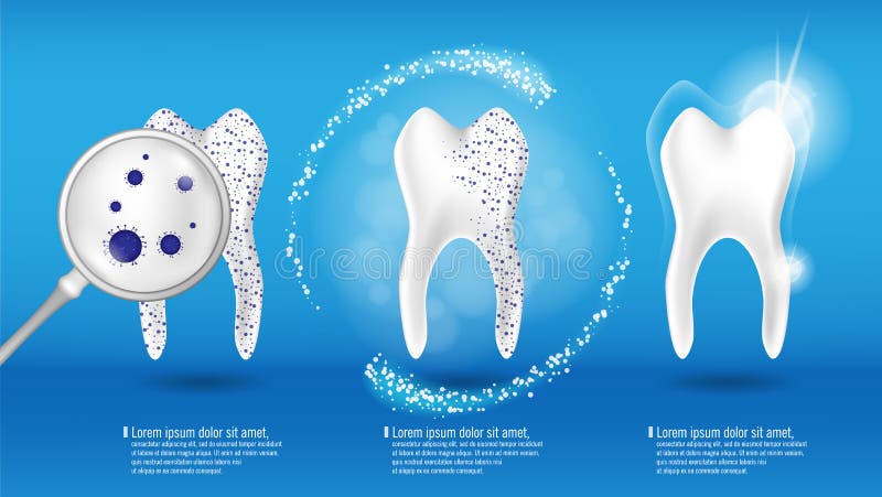 Soin oral et concept dentaire de santé Dent propre et sale brillante sur le fond bleu, processus de dégagement de dent dents illustration stock Soin oral et concept dentaire de santé Dent propre et sale brillante sur le fond bleu, processus de dégagement de dent dents illustration stock
