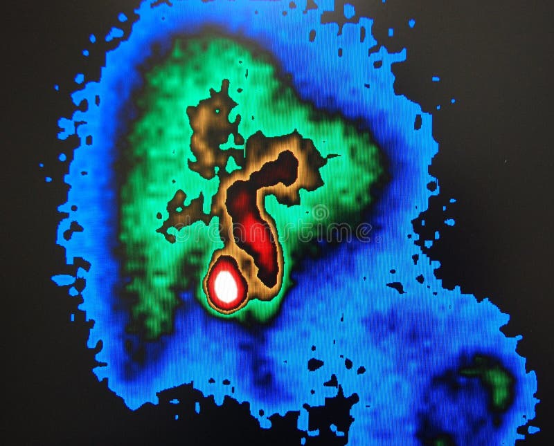 Its usually called hida scan for diagnostic of gallbladder duct pathology,liver has green color, gallbladder white with red contour , blue is background. Its usually called hida scan for diagnostic of gallbladder duct pathology,liver has green color, gallbladder white with red contour , blue is background